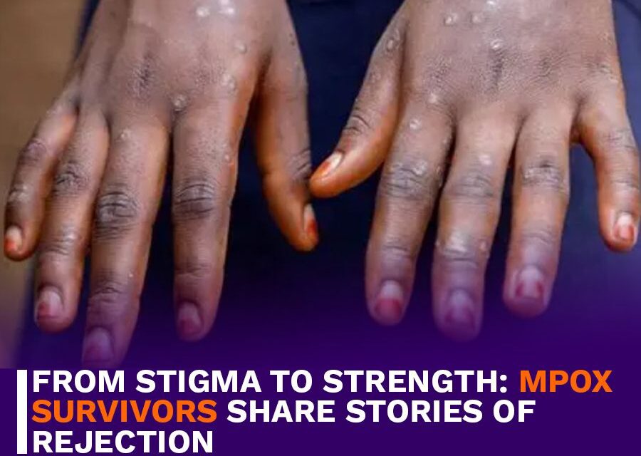 From Stigma to Strength: Mpox Survivors Share Stories of Rejection
