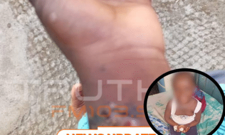 Three-Year-Old Faces Arm Amputation After Alleged Negligence at Cottage Hospital