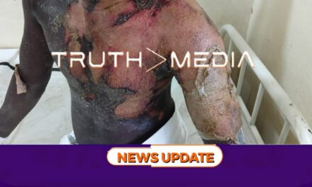 Man Set Ablaze in Kenema After Theft Allegation