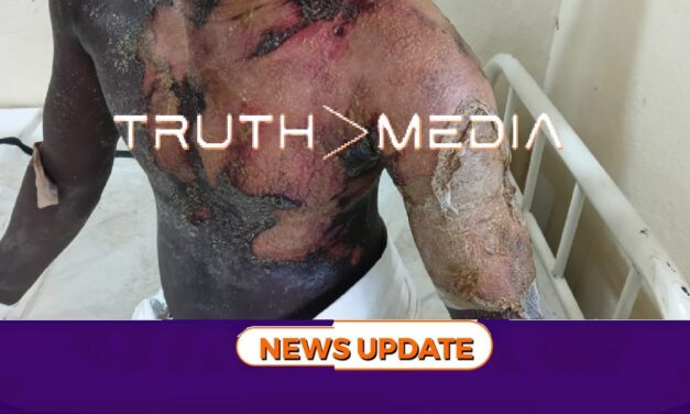 Man Set Ablaze in Kenema After Theft Allegation