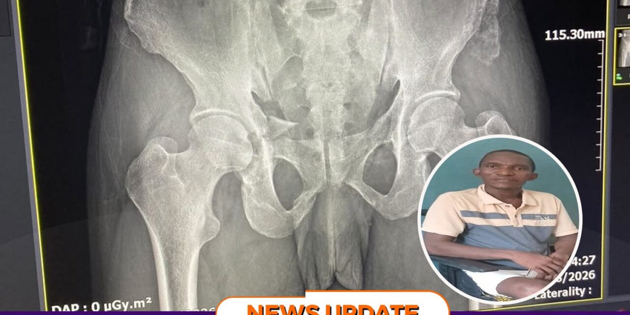 Injured Health Worker Seeks $15,000 for Specialized Pelvic Surgery in India