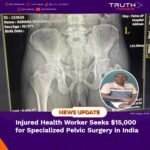 Injured Health Worker Seeks $15,000 for Specialized Pelvic Surgery in India